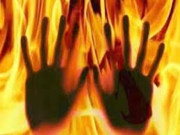 Woman set ablaze ‘by in-laws’ suffers 70pc burns